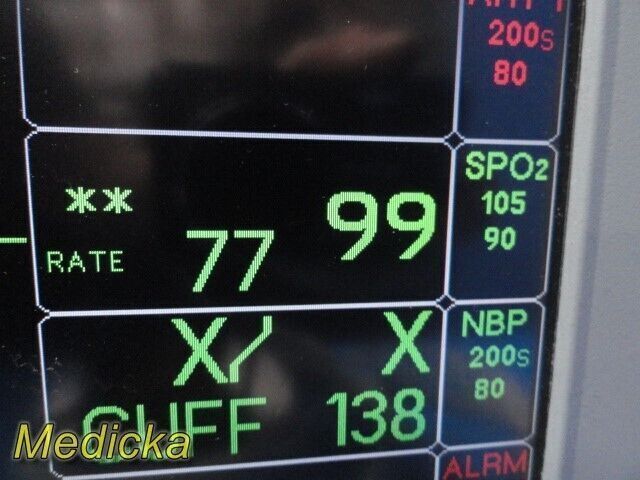 GE Dash 5000 Patient Monitor (NBP, ECG, SpO2, TEMP), photo 5